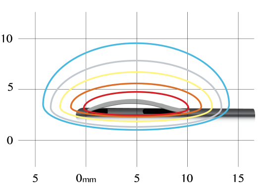 https://epimed.com/wp-content/uploads/2022/03/directional-lesioning-graph.png