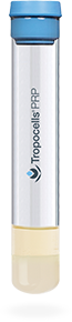 Tropocells PRP - Gel separation