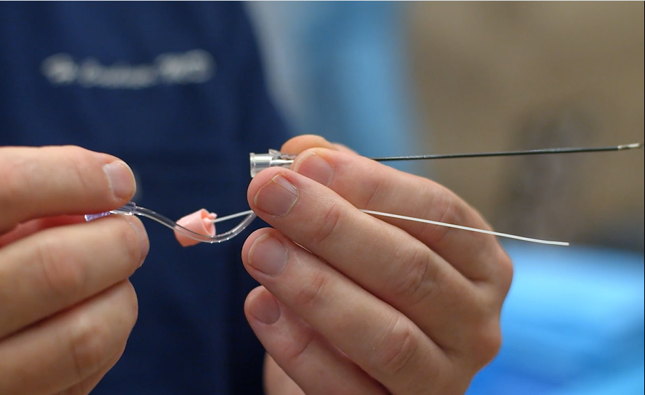 Dr. Harold Cordner holding the Epimed RF Flare™ Cannula, an advanced radiofrequency ablation needle.