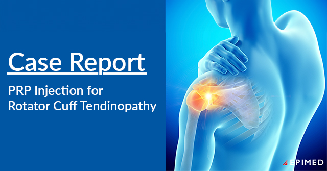 Illustration of Platelet-Rich Plasma (PRP) therapy for rotator cuff tendinopathy, showcasing an ultrasound-guided injection to promote tissue healing and pain relief.