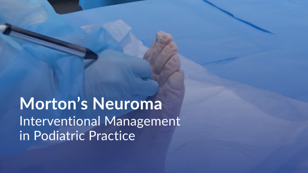 Gloved clinician examining the bottom of a patient’s foot with a medical instrument, with text reading “Morton’s Neuroma: Interventional Management in Podiatric Practice.”