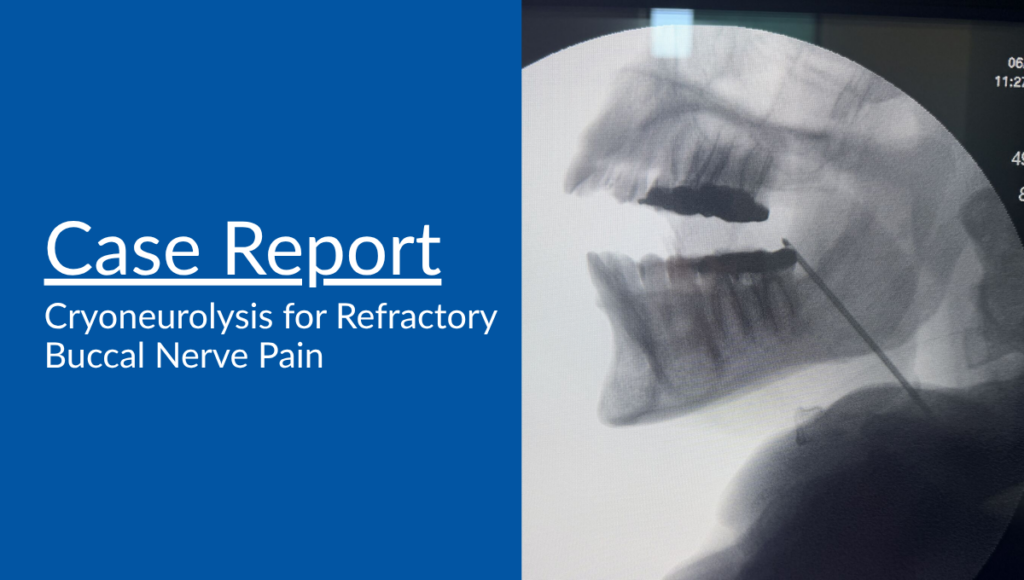 Case Report: Cryoneurolysis for Refractory Buccal Nerve Pain