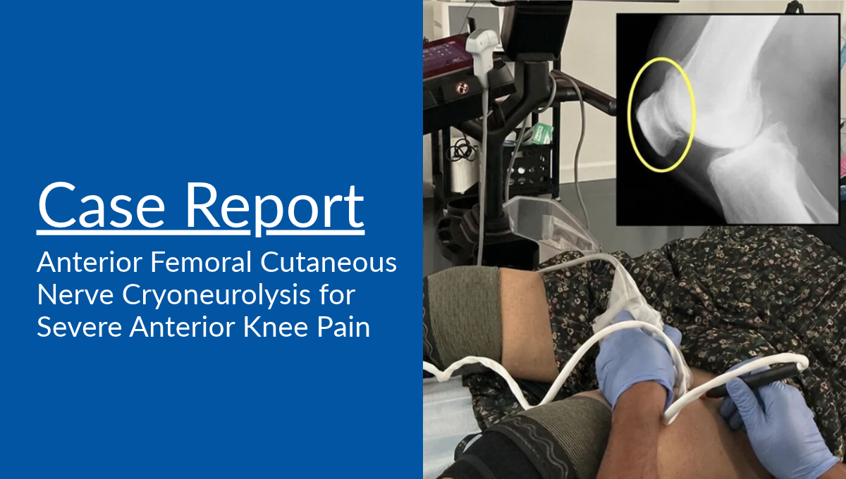 Clinical Case: Anterior Femoral Cutaneous Nerve Cryoneurolysis for Severe Anterior Knee Pain
