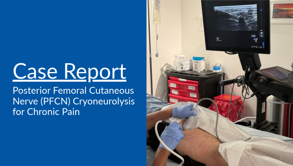 Ultrasound-guided cryoneurolysis procedure targeting the Posterior Femoral Cutaneous Nerve (PFCN)